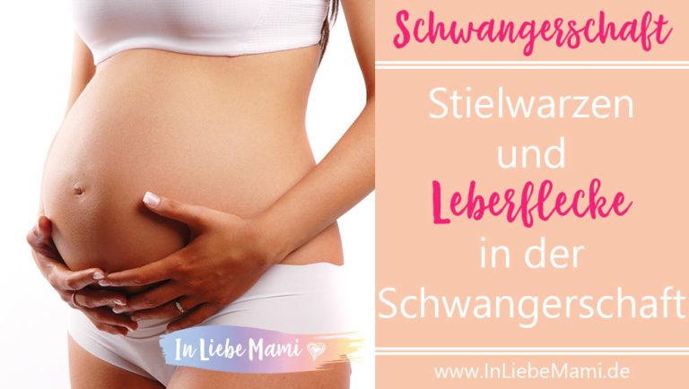 Stielwarzen und Leberflecke in der Schwangerschaft