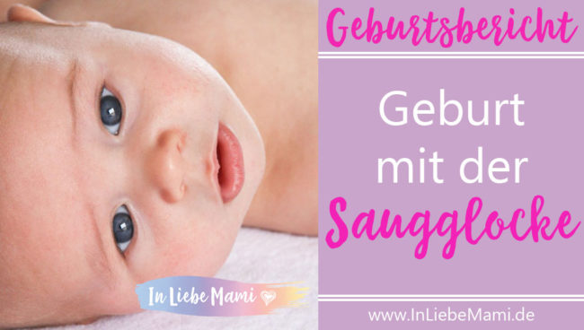 Geburtsbericht: Geburt mit der Saugglocke Geburtsbericht: Geburt mit der Saugglocke