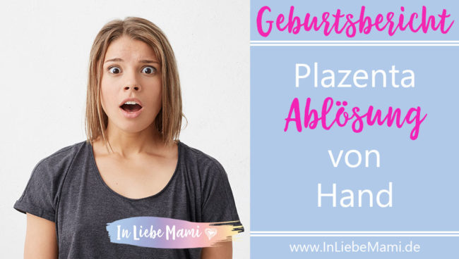 Geburtsbericht Plazenta-Ablösung Geburtsbericht Plazentaablösung per Hand